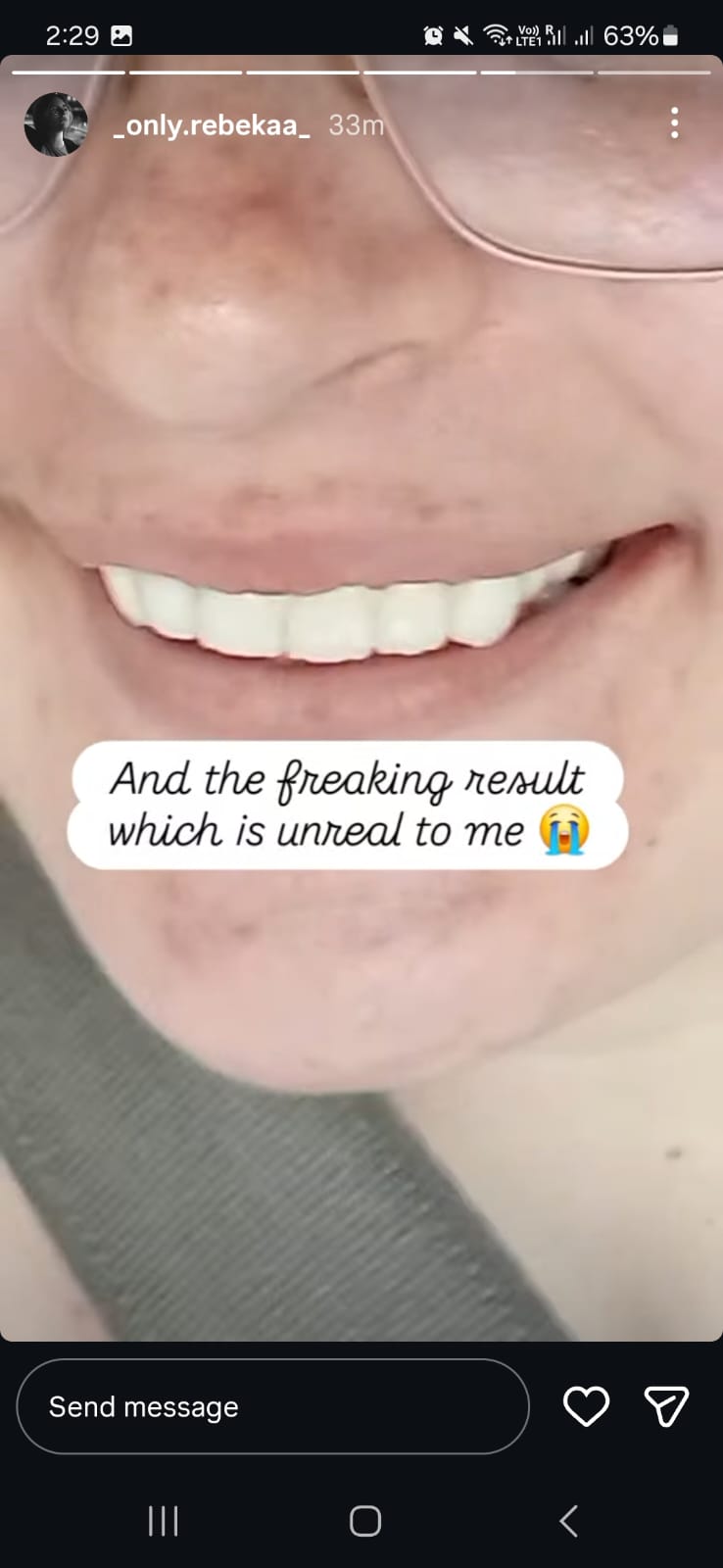 Rebeka's Instagram story — The freaking result which is unreal