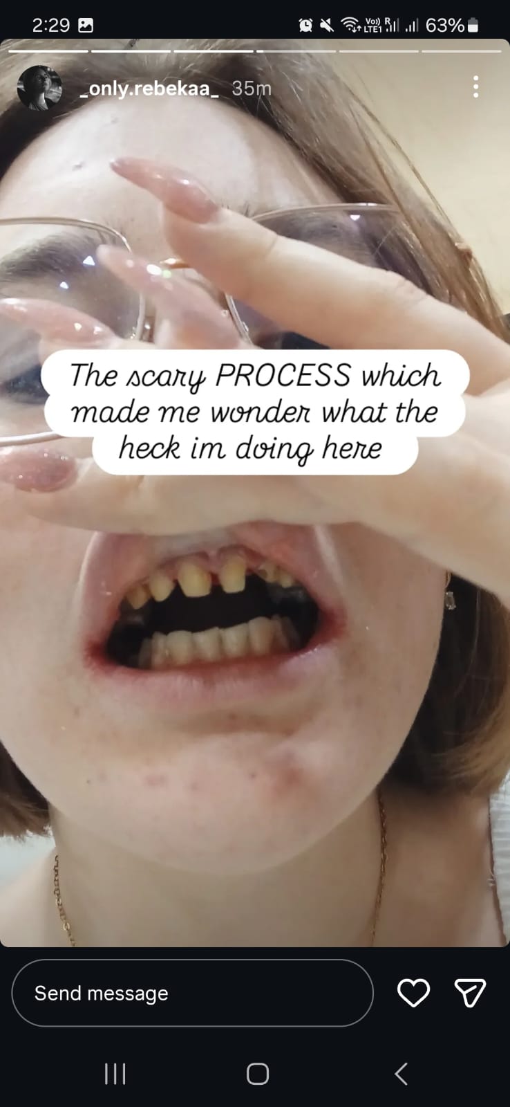 Rebeka's Instagram story — The scary process